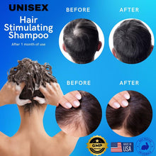 Load image into Gallery viewer, GREEN ROYALTY Minoxidil Shampoo – Sulfate-Free with Keratin &amp; Collagen – Deep Cleansing &amp; Nourishing Formula for Fuller, Thicker-Looking Hair – Unisex – 32oz (950ml)
