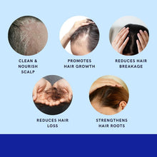 Load image into Gallery viewer, GREEN ROYALTY Minoxidil Shampoo – Sulfate-Free with Keratin &amp; Collagen – Deep Cleansing &amp; Nourishing Formula for Fuller, Thicker-Looking Hair – Unisex – 32oz (950ml)
